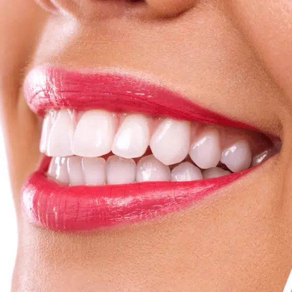 alexandra-hill-dental-home-service-min alexandra-hill-dental-home-service-min