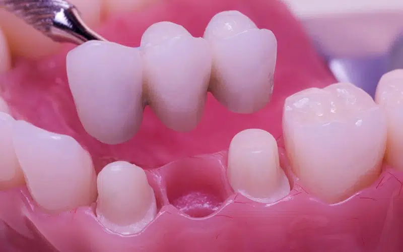 tooth image tooth image