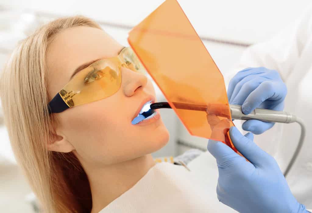 in-chair teeth whitening Capalaba