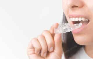 introduction to orthodontics
