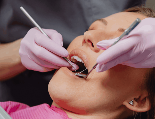 How Often Should You Have a Dental Check-Up and Clean?